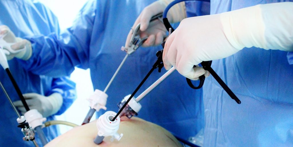 El Enfoque del Dr. Abrisqueta en Cirugía Laparoscópica: Beneficios para Pacientes