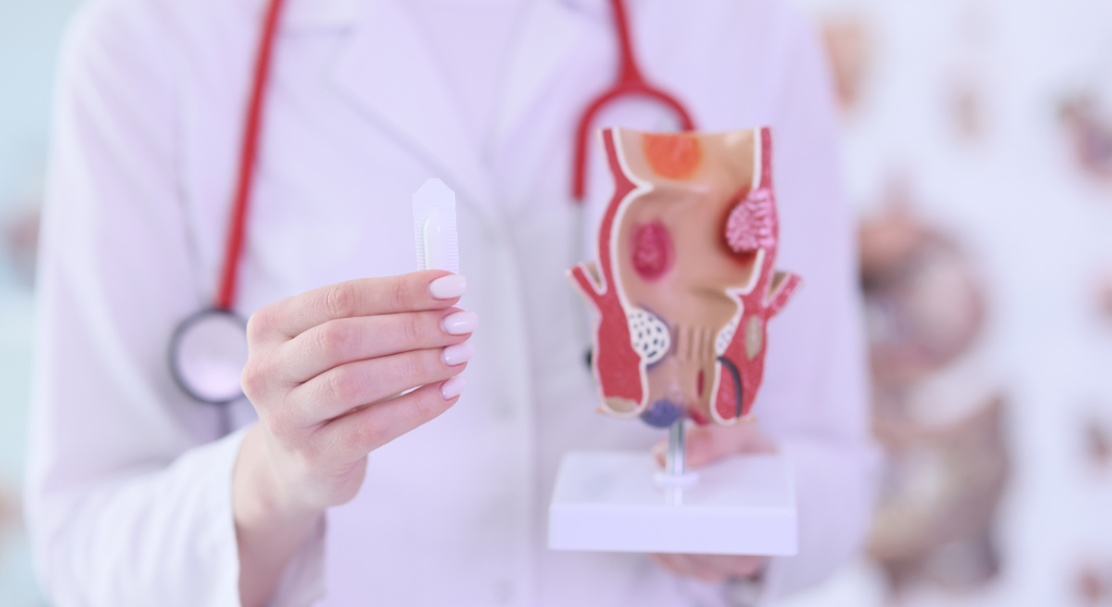 Diferencias entre hemorroides y fisura anal
