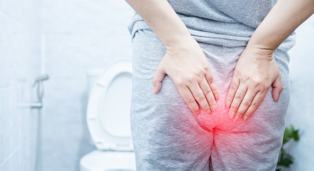 ¿Cómo es la recuperación tras una cirugía de hemorroides