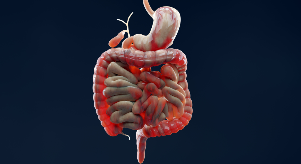 Enfermedad de Crohn y colitis ulcerosa_ síntomas y tratamiento