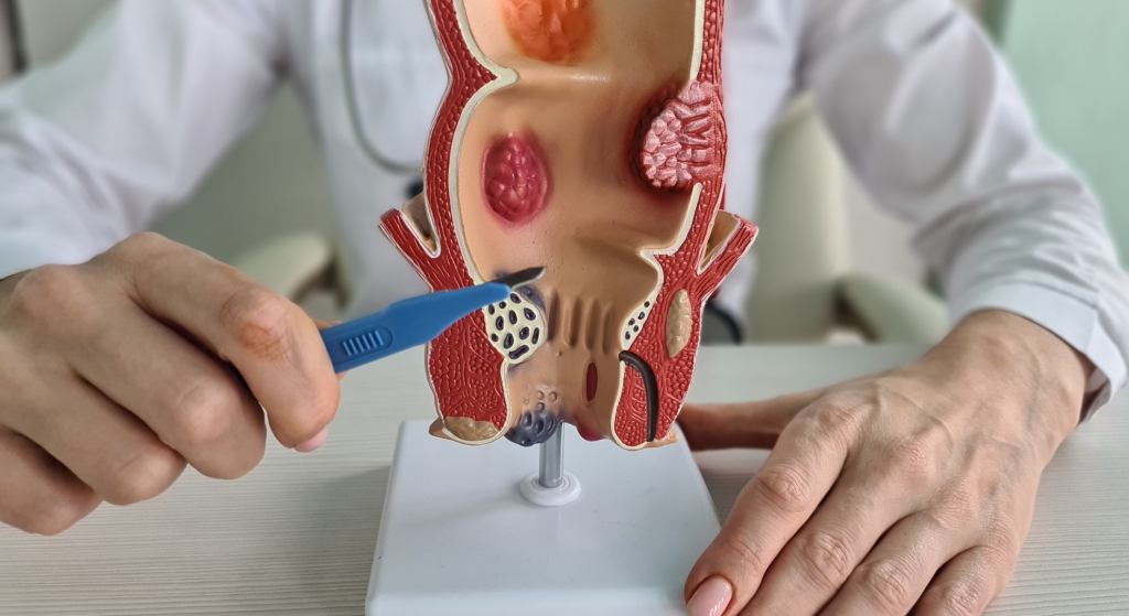 ¿Qué es la proctalgia fugaz y cómo tratarla