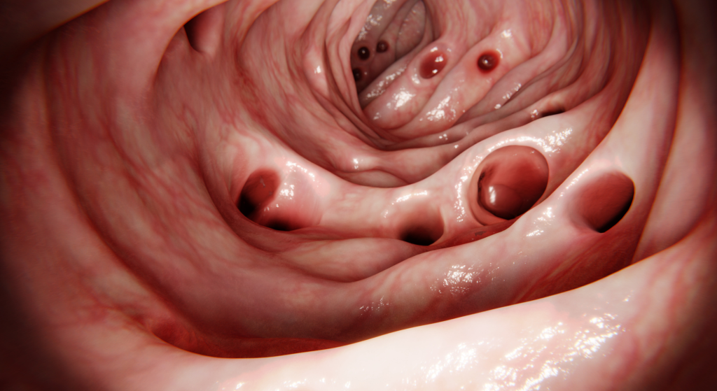 Biopsia colorrectal_ cuándo se necesita y qué resultados puede arrojar
