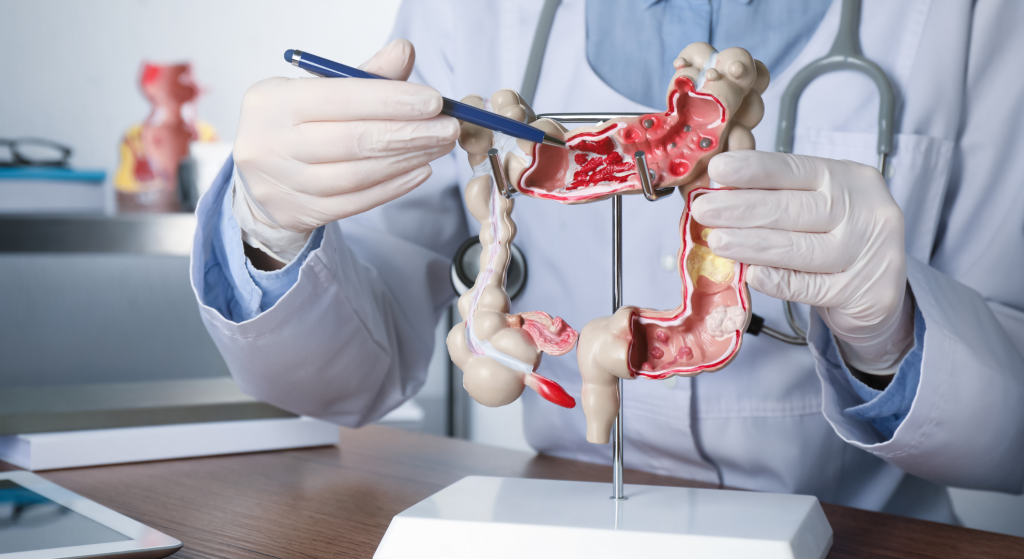 Inteligencia artificial en el diagnóstico del cáncer de colon