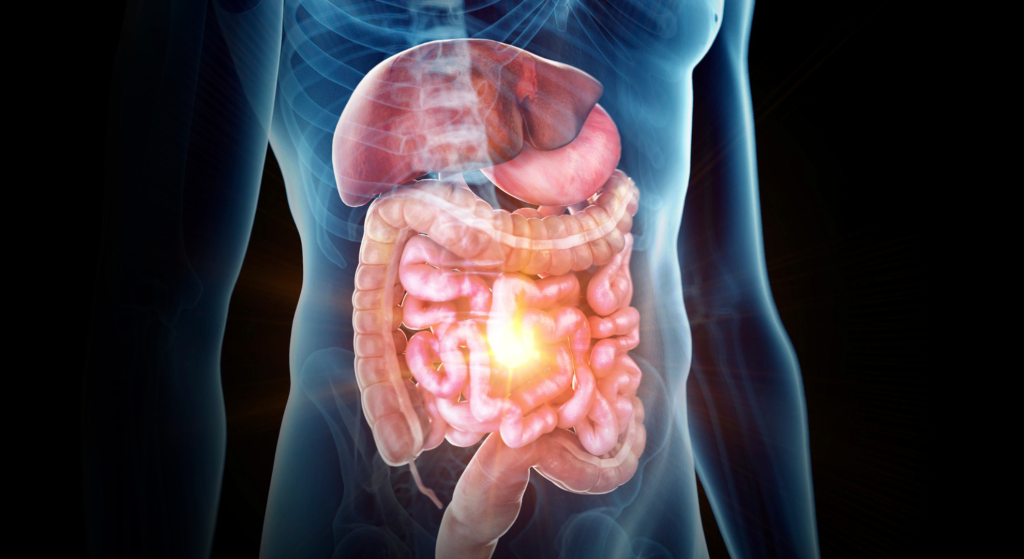 Innovaciones en el tratamiento de la enfermedad inflamatoria intestinal