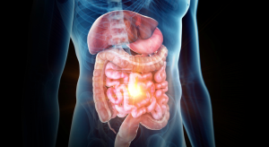 Innovaciones en el tratamiento de la enfermedad inflamatoria intestinal